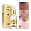 Images Serum Facial Suave Caracol Vitamina C Cierra Poros Aclara