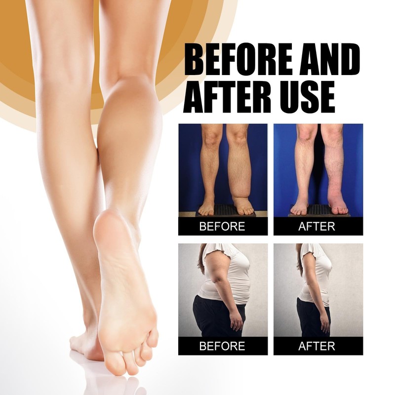 Massage Oil for Legs, Lymphatic Drainage Massage Oil,Massage Oi/l for