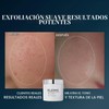 almohadillas para orejas ELEMIS Dynamic Resurface de 60 ct.