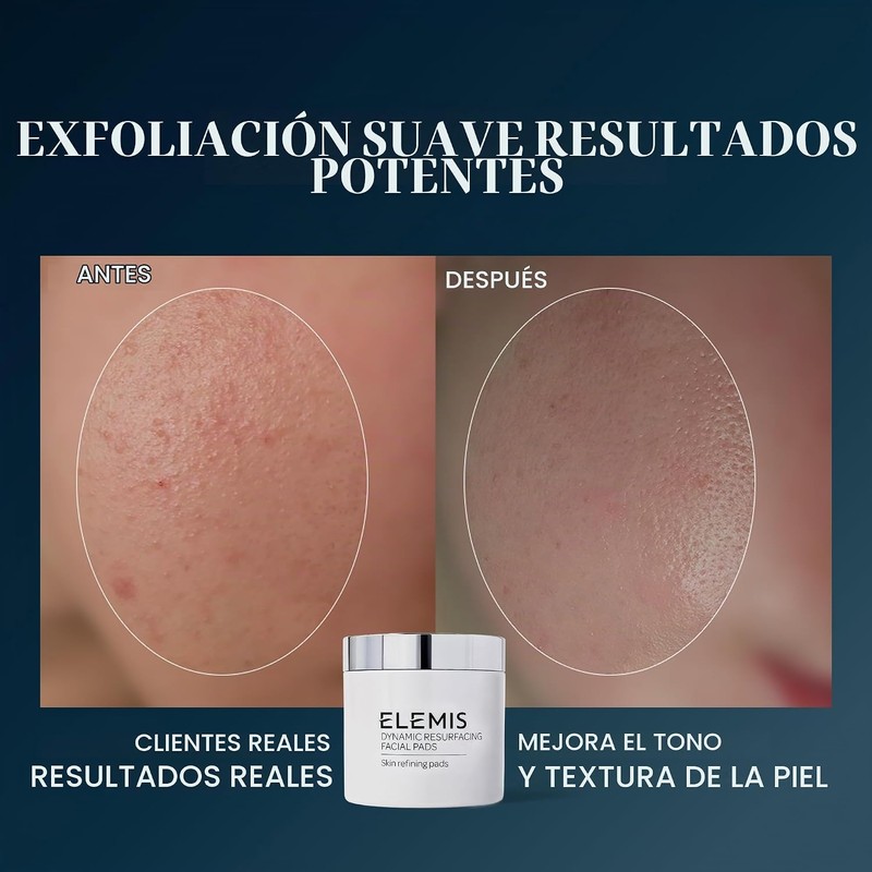 almohadillas para orejas ELEMIS Dynamic Resurface de 60 ct.