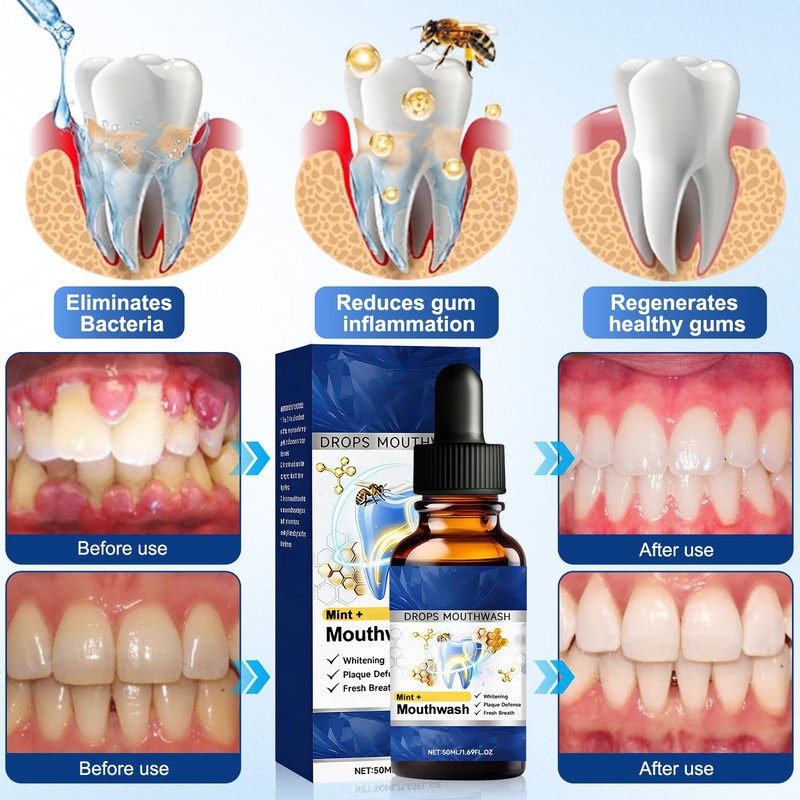 2PCS Beetakt Oral Repair Solution, Mint Flavored Oral Mouthwash，Effectively Improves