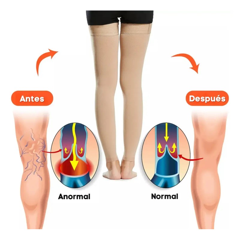2 Pares Medias Médicas Compresión Piernas Muslos, 23-32 M