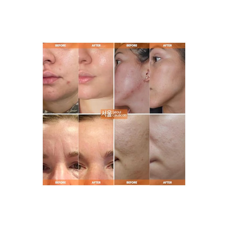 SeoulCeuticals Crema Multiusos con Extracto de Caracol, Vitamina E y