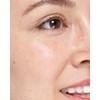 Mighty Patch Original from Hero Cosmetics - Medical-grade Hydrocolloid Pimple