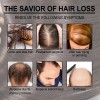 3pcs Hair Growth Aceite Esencial Romero 100% Puro Natural