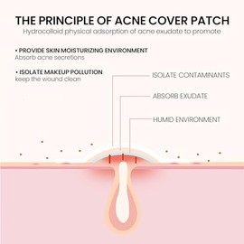 Parches para Espinillas y Acné, para Piel Grasa Mixta o con Imperfecciones | Cuidado de Piel con Imperfecciones, Elimina Espinillas, Cubre Manchas, Ab