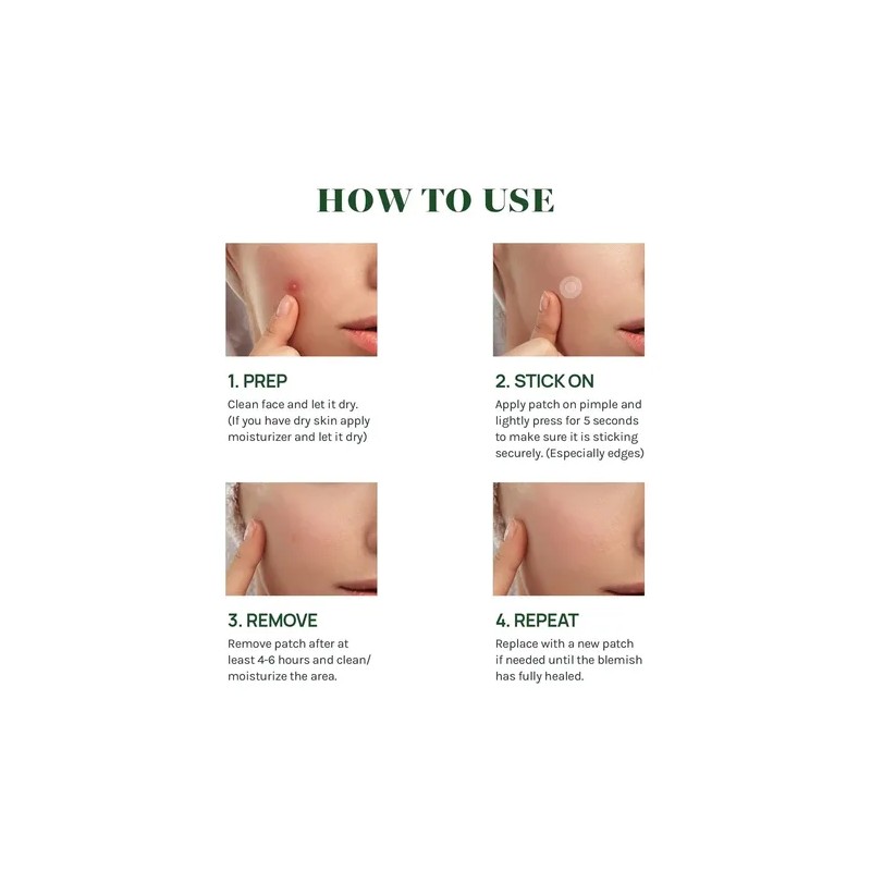 Cover Healing Invisible Acne Patch Blemish Spot, Treatment,