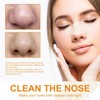 Grospe Blackhead Removal Nose Patch,Deep Cleansing Pore Strips,Instant Pore Unclogging,Deep