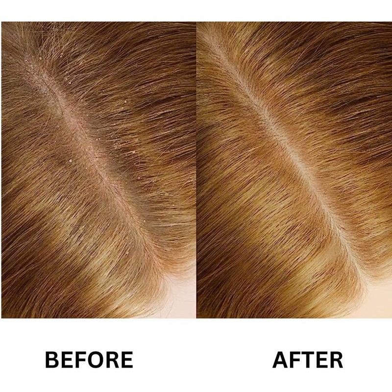Suero para el Crecimiento del Cabello (30ml) - Fórmula Anti-Frizz