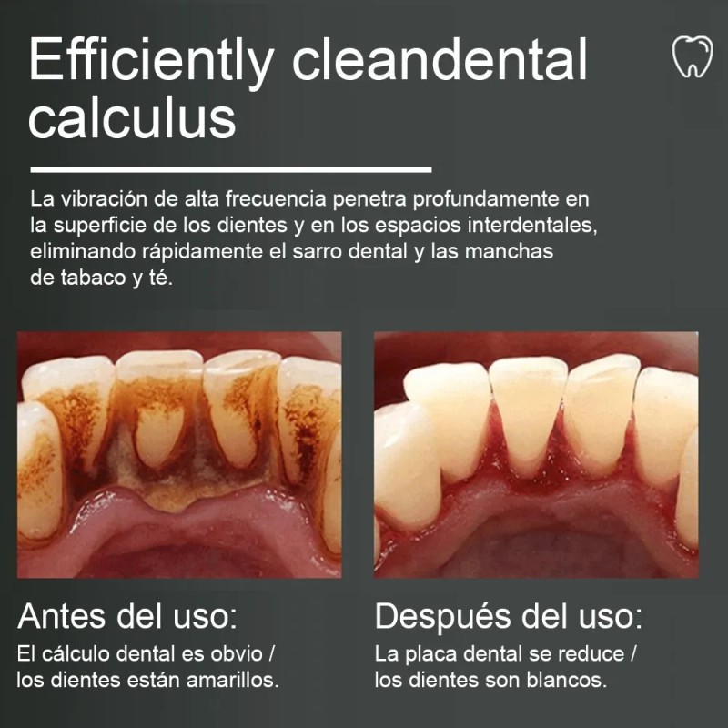 Kit Cepillo Dientes Eléctrico Limpieza Sarro 5modes