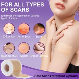 Cinta de silicona para eliminar cicatrices，elimina cicatrices antiguas y nuevas, hojas de eliminación para cesárea, cirugía, quemaduras, reducción de queloides, acné（4cm*1.5m)