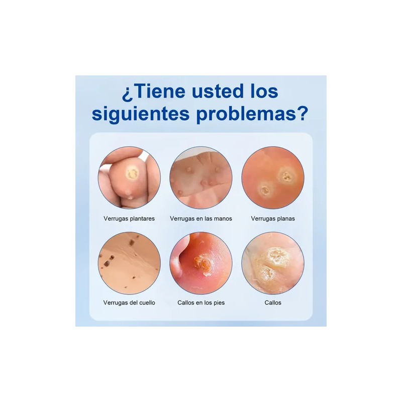 Crema Para Verrugas Elimina Eficazmente Y Cuida La Piel 20g
