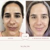 NUNUN Skin. Serum Facial Anti Arrugas, Vitamina C, Extracto Estrella