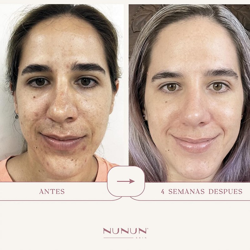 NUNUN Skin. Serum Facial Anti Arrugas, Vitamina C, Extracto Estrella
