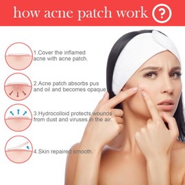 300 Pcs Pimple Patches Salicylic Acid Spot Patches Hydrocolloid Invisible Blemish Spot Facial Skin Care Treatment Acne Patch For Day and Night Use 2-in 1