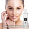 Ultrasónico Exfoliación Limpiador Cuidar Piel,skin Scrubber