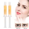 MELAO Moisturizing Fade Dark Circle Eye Bag Anti Wrinkle Eye