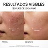 SKINTIFIC Ectoin Crema Hidratante en Gel para Piel Sensible, 30g,