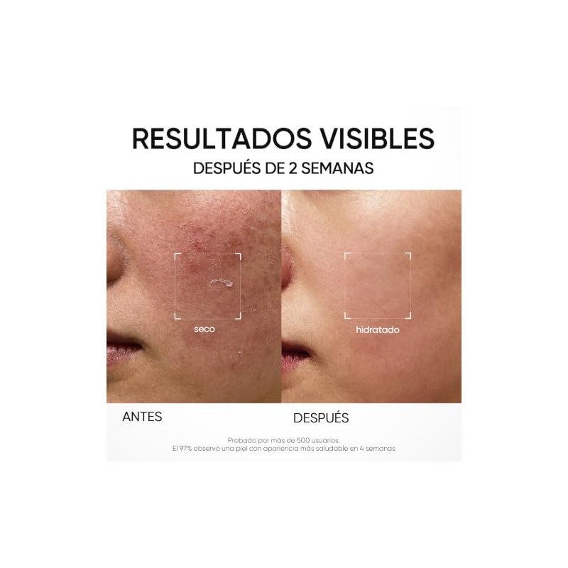 SKINTIFIC Ectoin Crema Hidratante en Gel para Piel Sensible, 30g,