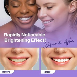 Purple Teeth Whitening Toothpaste, Teeth Whitening, Purple Toothpaste, Purple Whitening Toothpaste for Adults, Teeth Whitening Purple Toothpaste, Teeth Whitening Purple 30ml