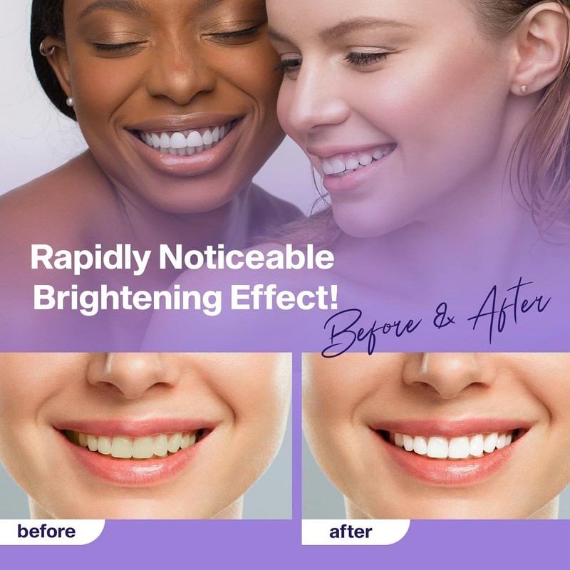 Purple Teeth Whitening Toothpaste, Teeth Whitening, Purple Toothpaste, Purple Whitening