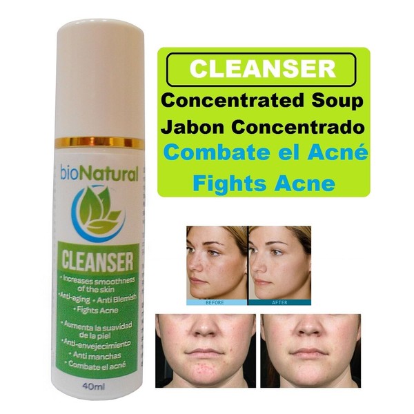 1 Cleansing Glycolic Cream Acne 1 crema para acne de limpieza glicolico