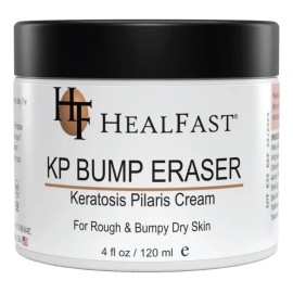 Bump Eraser Cream 4 Oz Soften, Nourish Rough And Bumpy