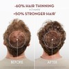 Klorane Shampoo with Quinine and B Vitamins for Thinning Hair,