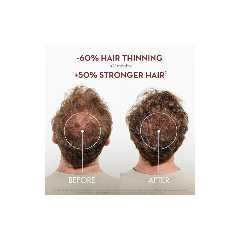 Klorane Shampoo with Quinine and B Vitamins for Thinning Hair,