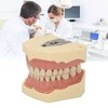 Dental Teaching Model Soft Gum 32 Teeth Dental Demonstration Teeth