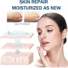 Srum De Microagujas Con cido Hialurnico Para Rostro, Hidr