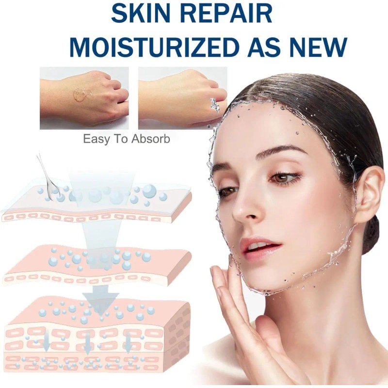 Srum De Microagujas Con cido Hialurnico Para Rostro, Hidr