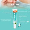 Duopack Crema Repelente Para Bebe De Mosquitos + After Bites