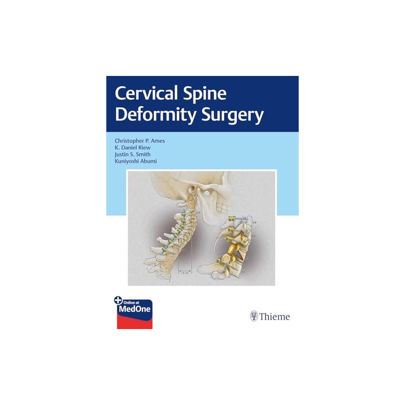 Cervical Spine Deformity Surgery