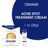 Clearasil Benzoyl Peroxide Stubborn Acne Spot Treatment Cream, 1 oz