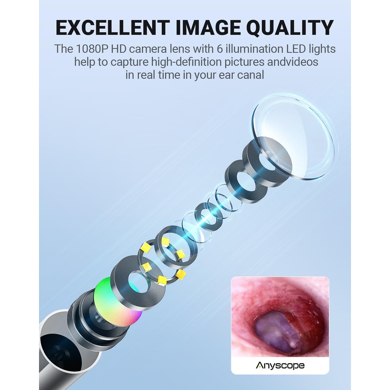 AnyScope AnyScope Digital Otoscope with Gyroscope, HD Ear Camera with