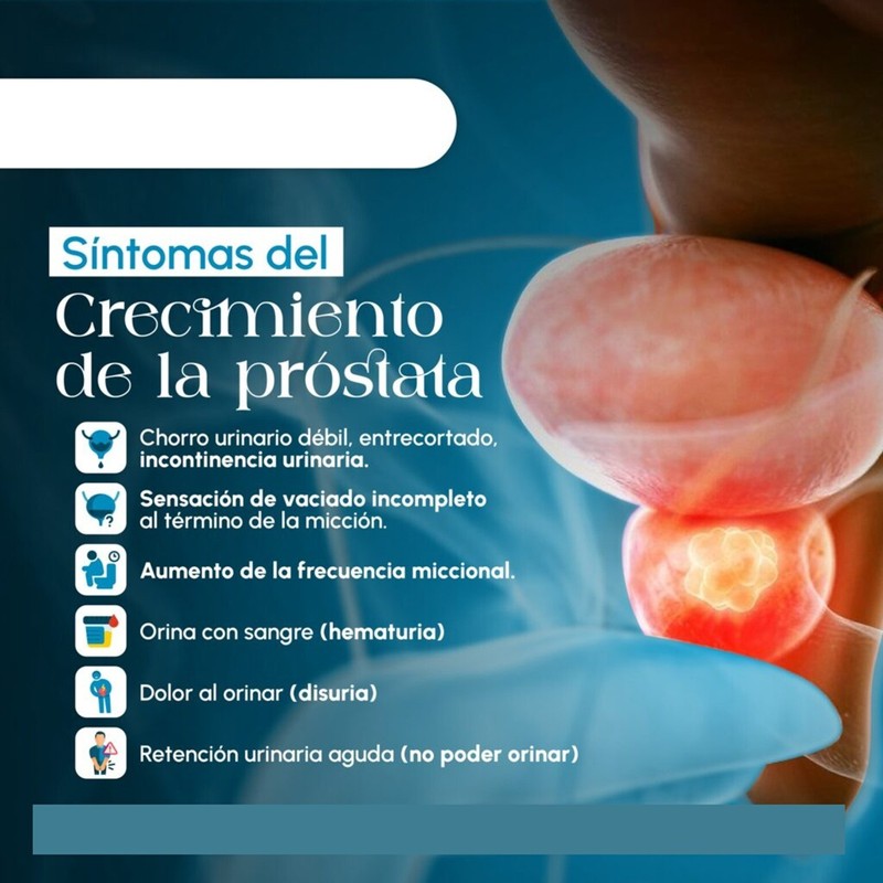 SUPPLEMENT4ME.COM NATURAL HELP FOR ENLARGED PROSTATE (BPH) - 100% HERBAL