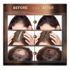 Sérum Re:act Minoxi Roll-on Para El Crecimiento Del Cabello,