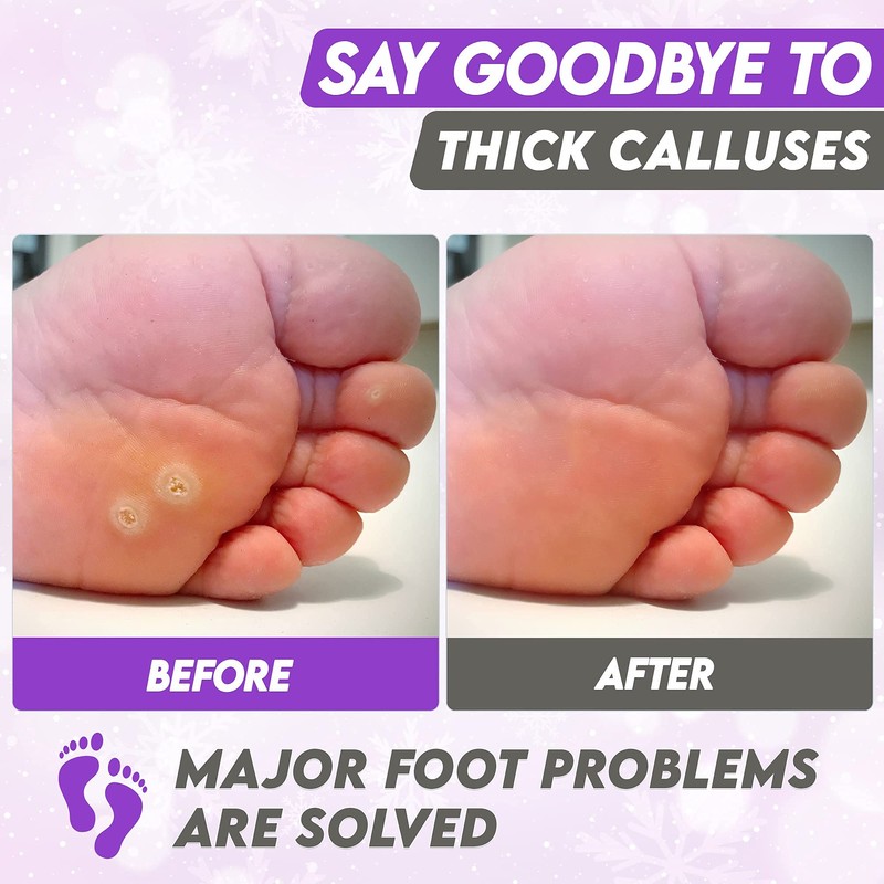 Foot Peel Mask Lavender Moisturizing Exfoliating Foot Masks - Karma