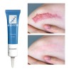 Gel Crema Cicatrizante Cuerpo Alliance Pharma Reductor Cicatrices Kelo Cote