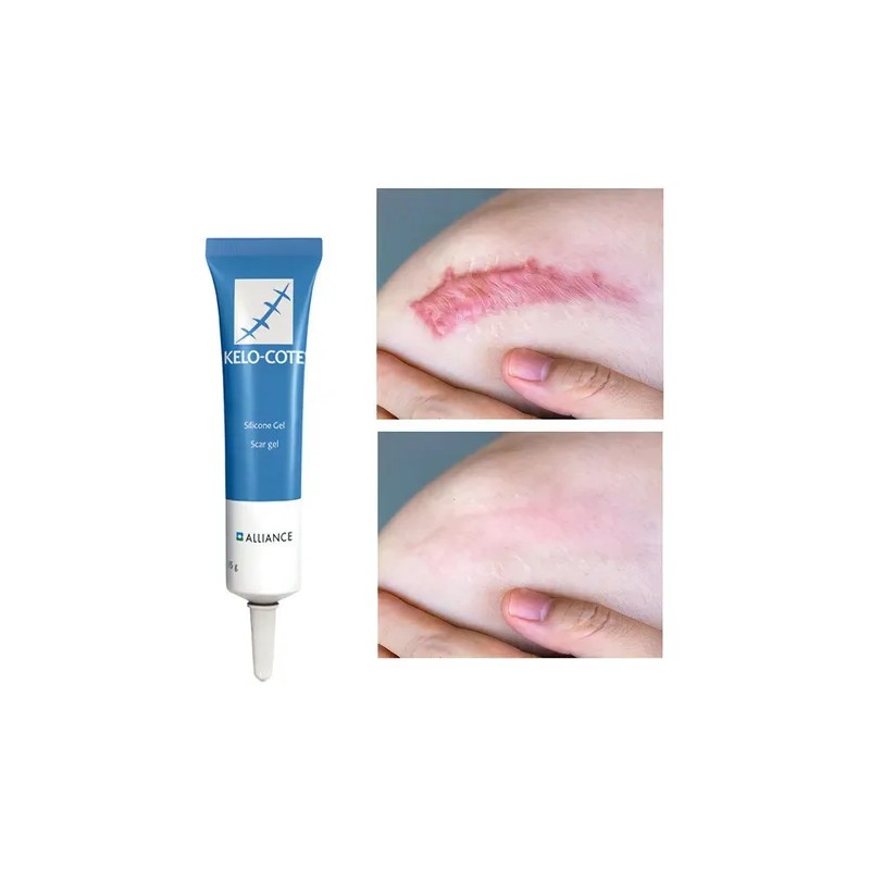Gel Crema Cicatrizante Cuerpo Alliance Pharma Reductor Cicatrices Kelo Cote