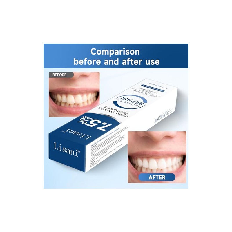 Set 2-Pack Hydroxyapatite Toothpaste for Teeth Remineralization, Enamel Repair, Sensitivity
