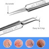 3PCS Blackhead Remover Tweezers and 1PC Ingrown Hair Tweezers, Precision