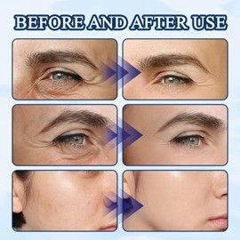 Serum Soforteffekt Gesicht 2PCS,Creme Anti-Aging,Serum Gesicht Anti Aging Reduziert Falten,Serum Soforteffekt Gesicht Stimuliert Kollagen,Geeignet für Alle Hauttypen