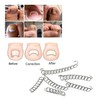 Suweiyuanshiyi Ingrown Toenail Removal Kit,Ingrown Toenail Corrector Tools Come with