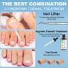Ingrown Toenail Treatment w/Ingrown Toenail Drops Reliever & Softener,Double Sided