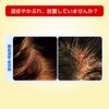 【指定第2類医薬品】メンソレータム メディクイックHゴールド 30ml