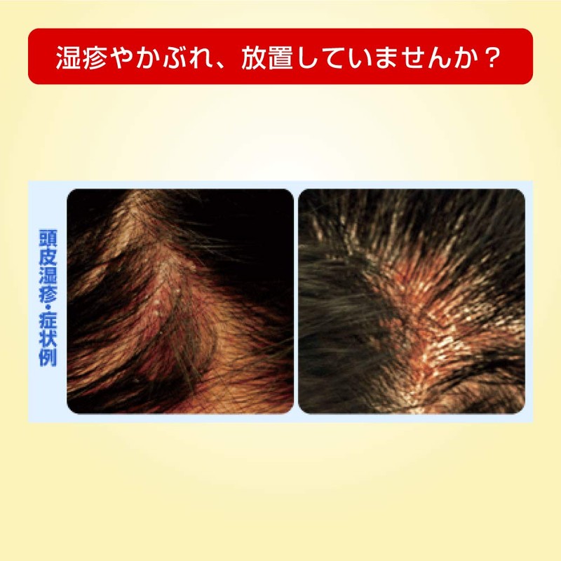 【指定第2類医薬品】メンソレータム メディクイックHゴールド 30ml
