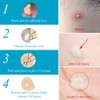 Lanbena Parches Anti Acne, Tratamiento Completo Día Y Noche