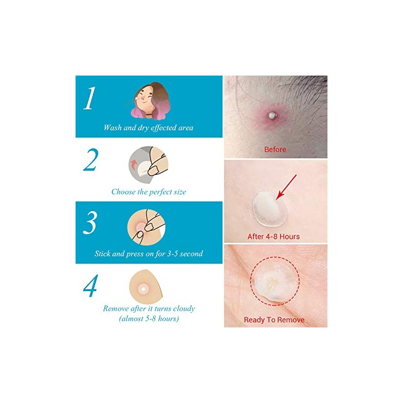 Lanbena Parches Anti Acne, Tratamiento Completo Día Y Noche
